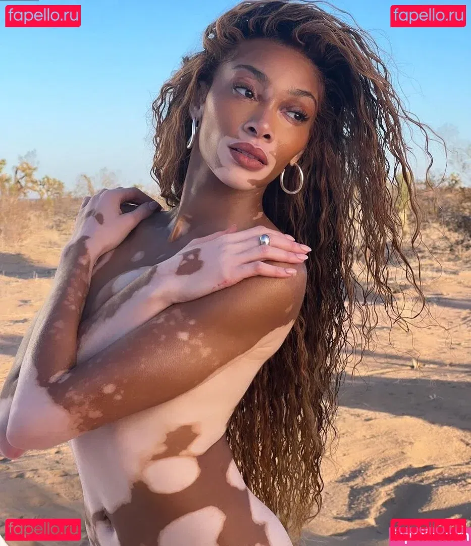Winnie Harlow Onlyfans Photo Gallery 