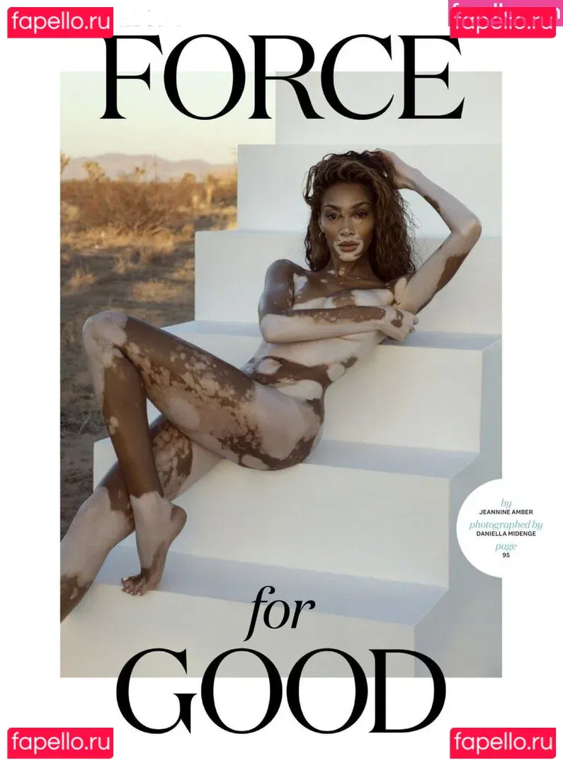 Winnie Harlow Onlyfans Photo Gallery 