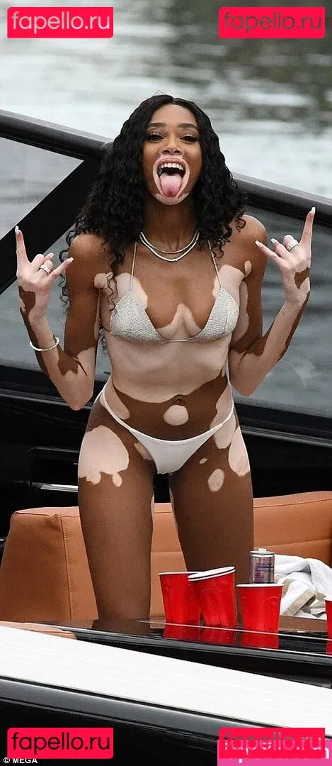Winnie Harlow Onlyfans Photo Gallery 