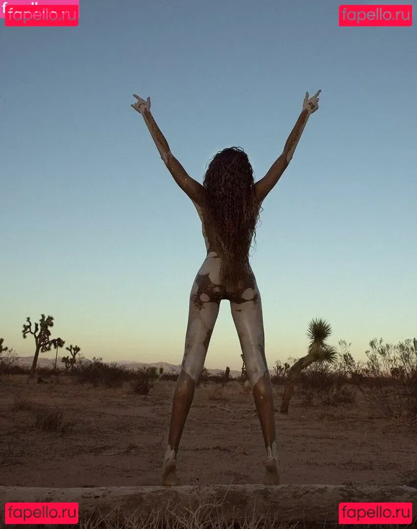 Winnie Harlow Onlyfans Photo Gallery 