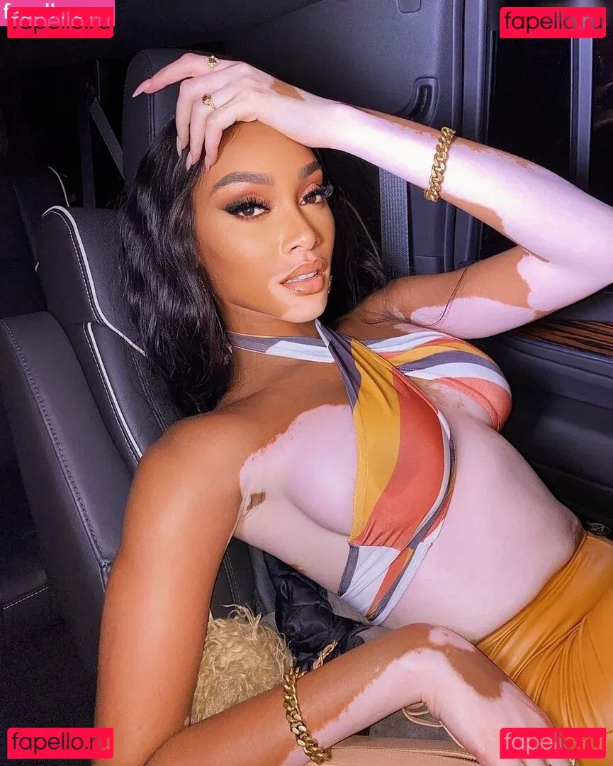 Winnie Harlow Onlyfans Photo Gallery 