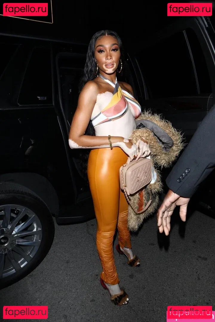 Winnie Harlow Onlyfans Photo Gallery 