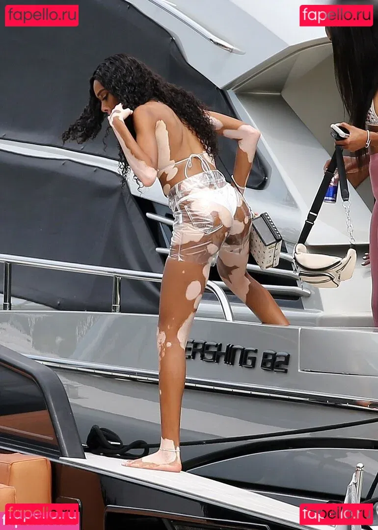Winnie Harlow Onlyfans Photo Gallery 