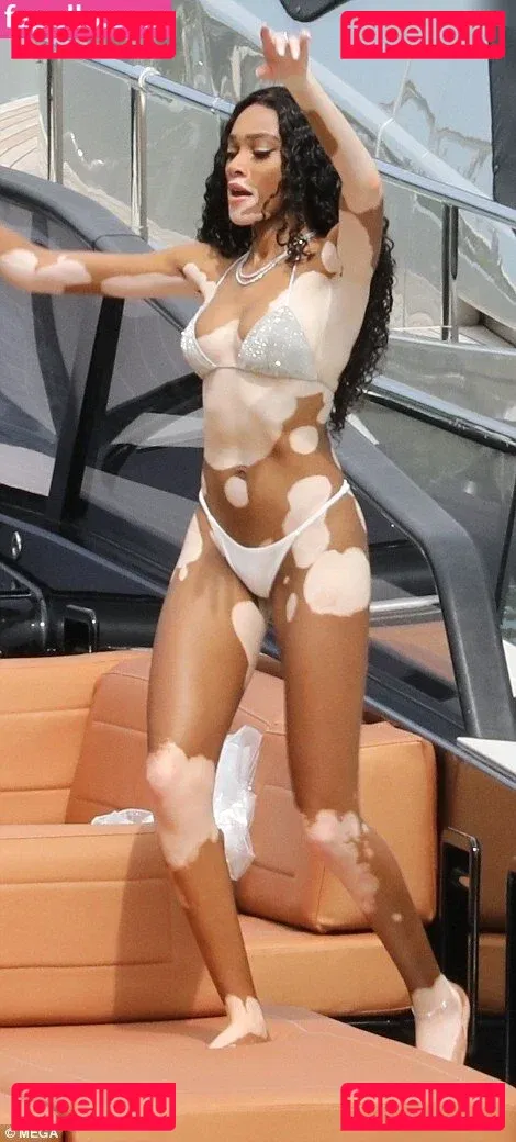 Winnie Harlow Onlyfans Photo Gallery 