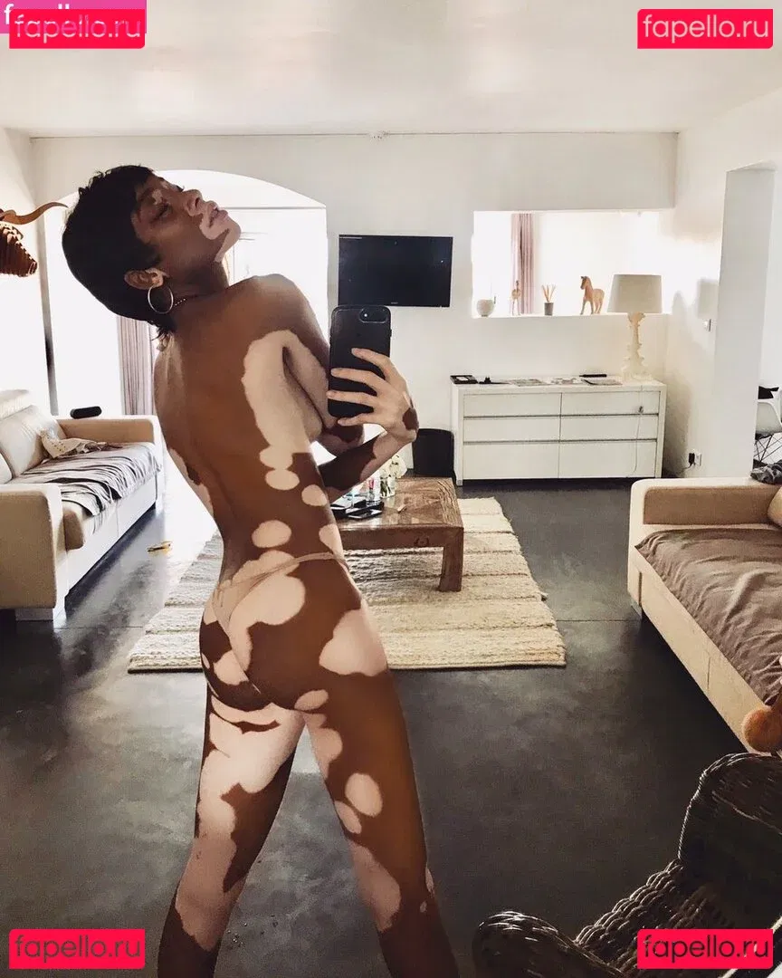 Winnie Harlow Onlyfans Photo Gallery 