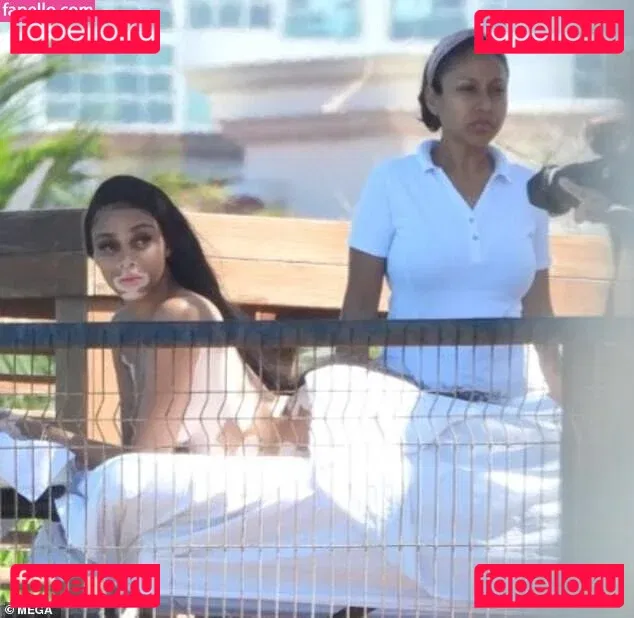 Winnie Harlow Onlyfans Photo Gallery 