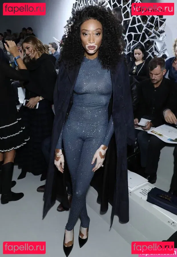 Winnie Harlow Onlyfans Photo Gallery 