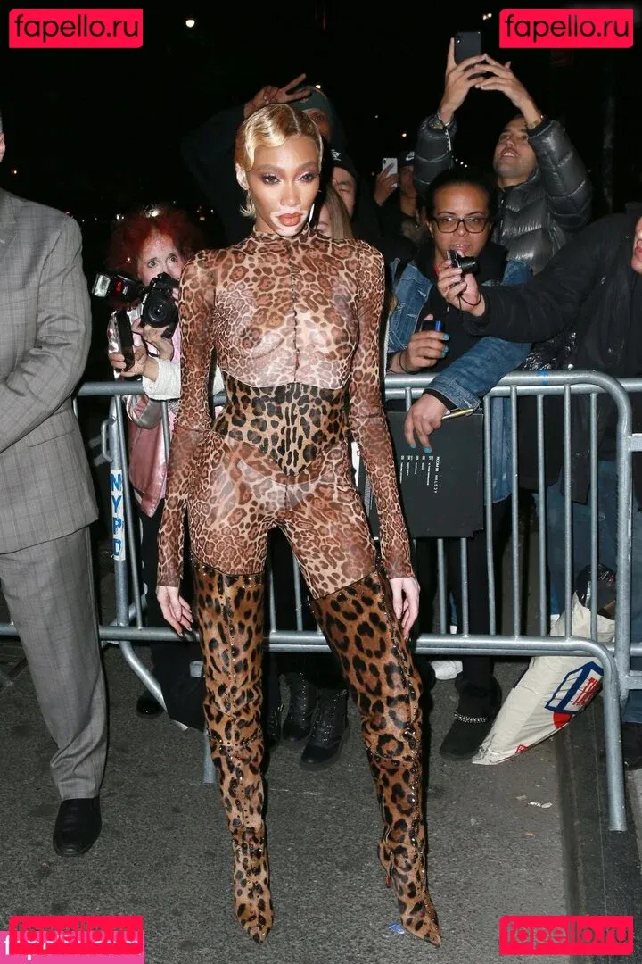 Winnie Harlow Onlyfans Photo Gallery 