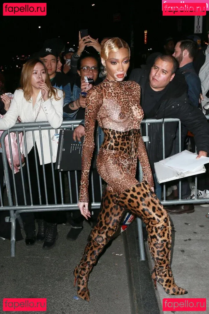 Winnie Harlow Onlyfans Photo Gallery 