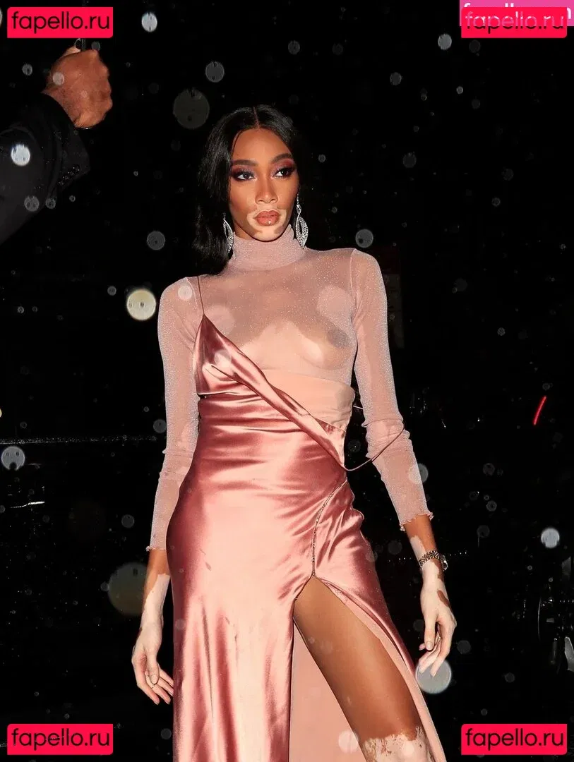 Winnie Harlow Onlyfans Photo Gallery 