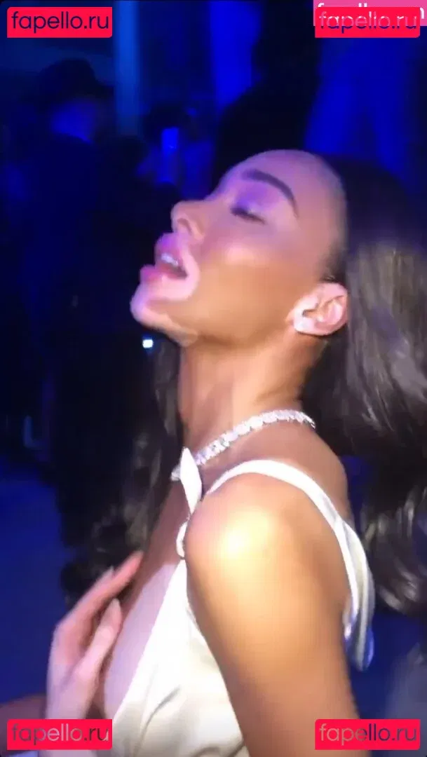 Winnie Harlow Onlyfans Photo Gallery 