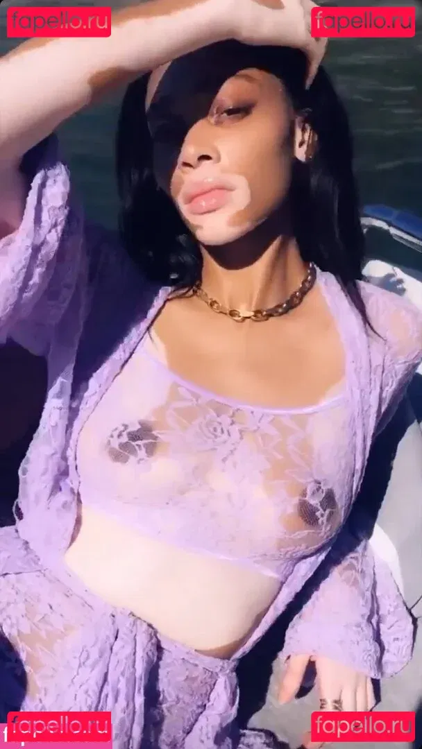 Winnie Harlow Onlyfans Photo Gallery 