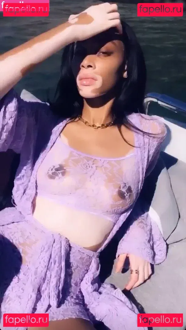 Winnie Harlow Onlyfans Photo Gallery 