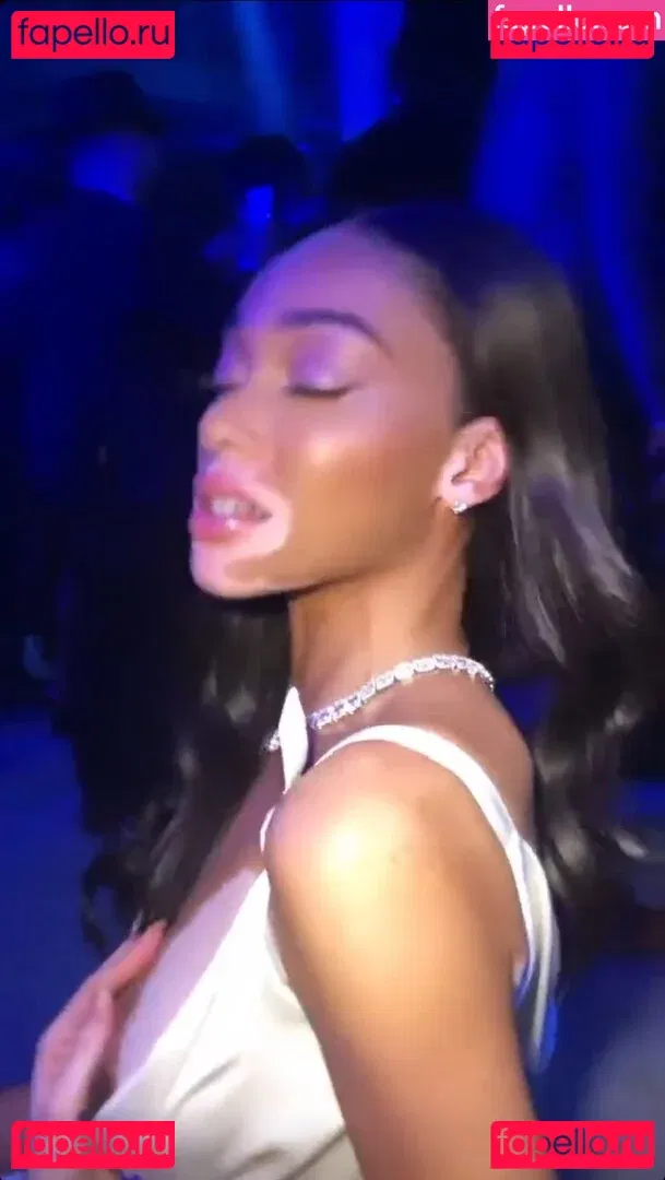 Winnie Harlow Onlyfans Photo Gallery 
