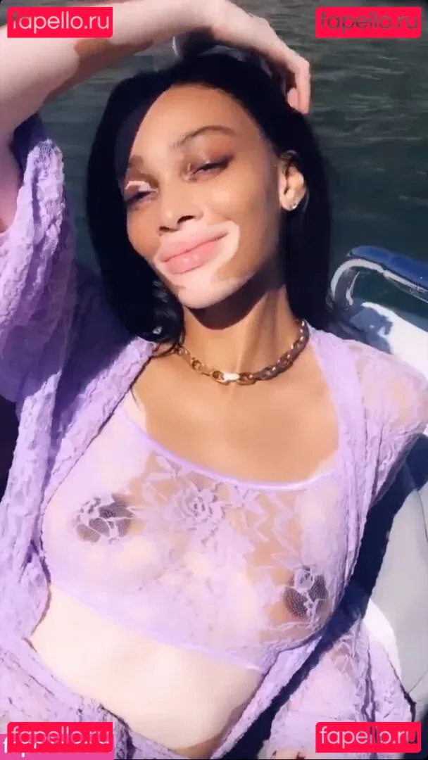Winnie Harlow Onlyfans Photo Gallery 