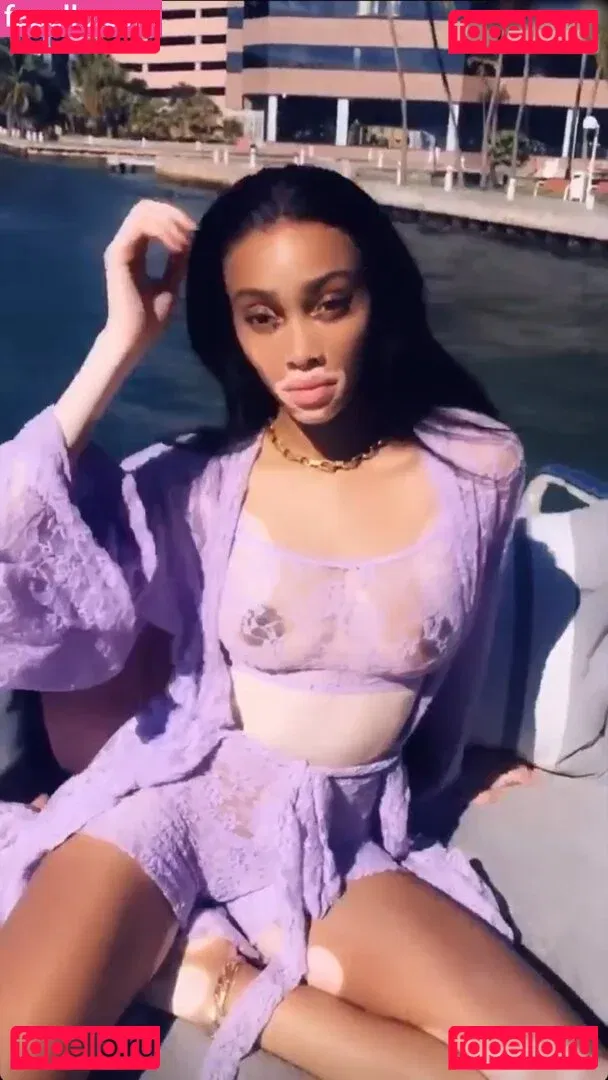 Winnie Harlow Onlyfans Photo Gallery 