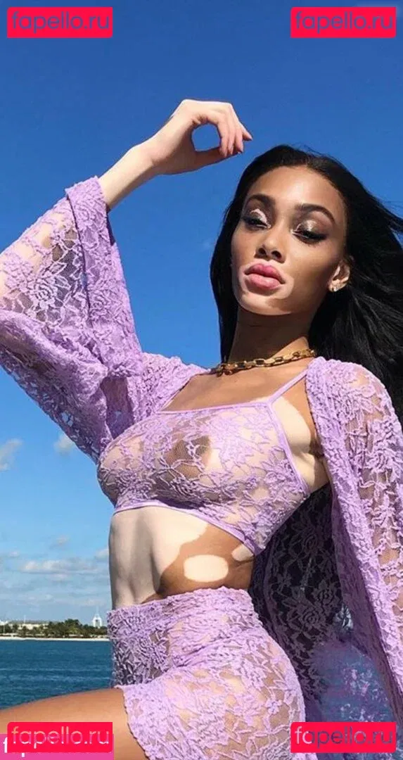 Winnie Harlow Onlyfans Photo Gallery 