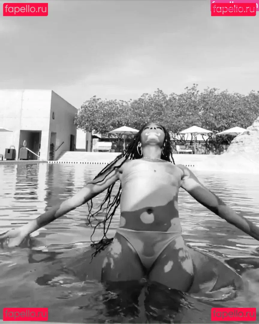 Winnie Harlow Onlyfans Photo Gallery 