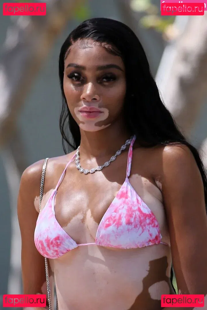 Winnie Harlow Onlyfans Photo Gallery 