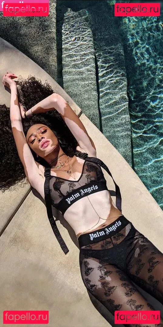 Winnie Harlow Onlyfans Photo Gallery 