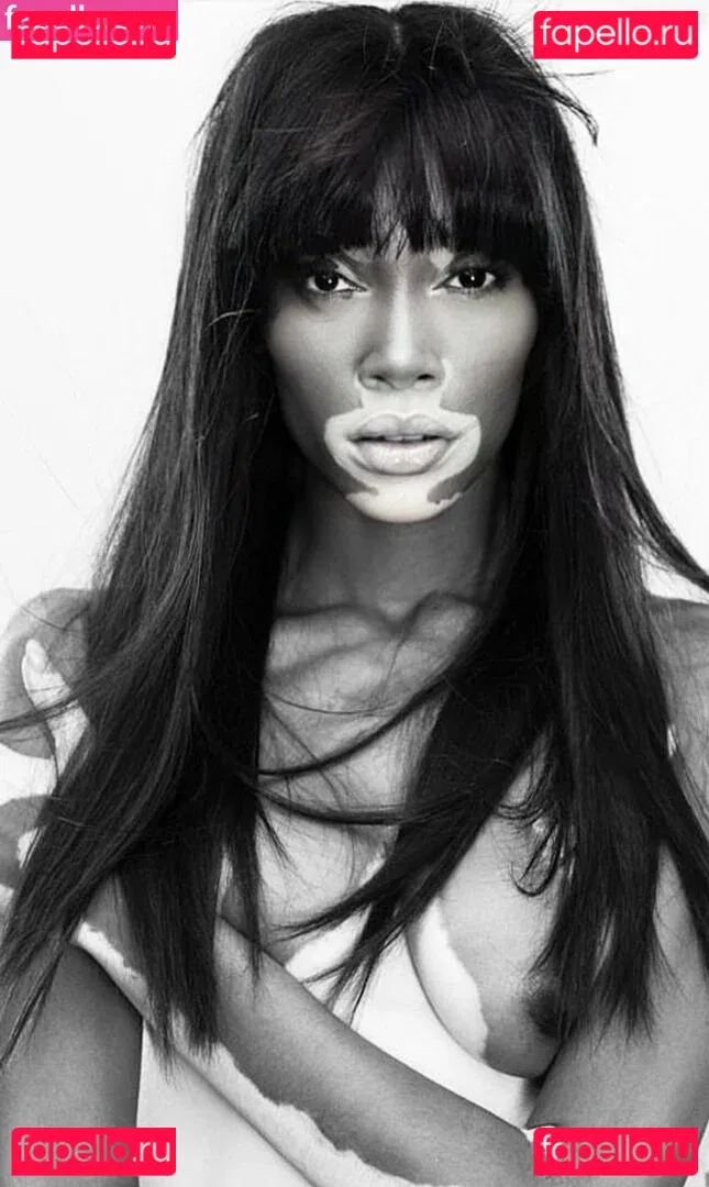 Winnie Harlow Onlyfans Photo Gallery 