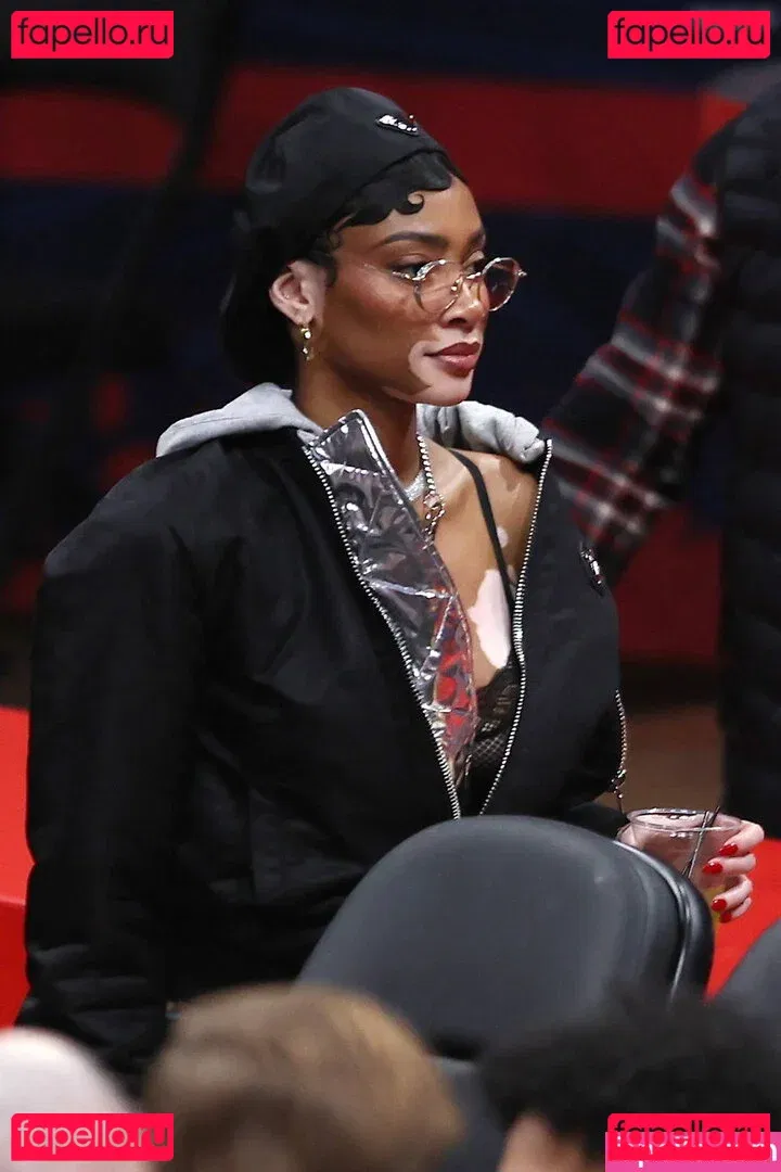 Winnie Harlow Onlyfans Photo Gallery 