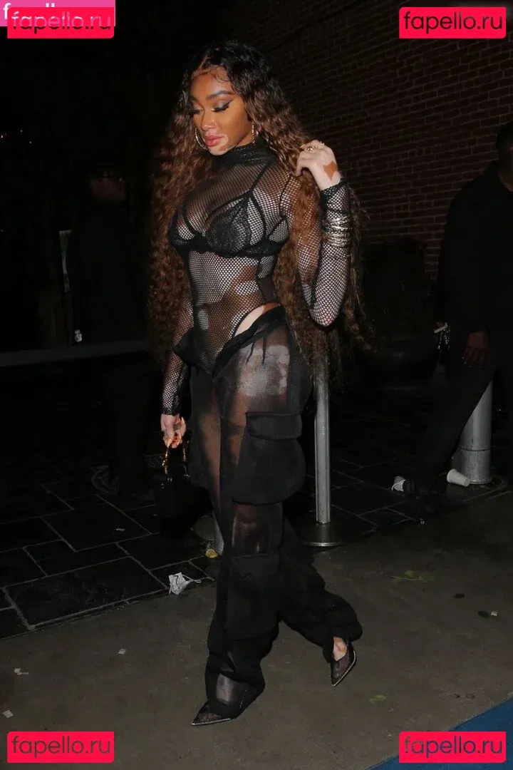 Winnie Harlow Onlyfans Photo Gallery 