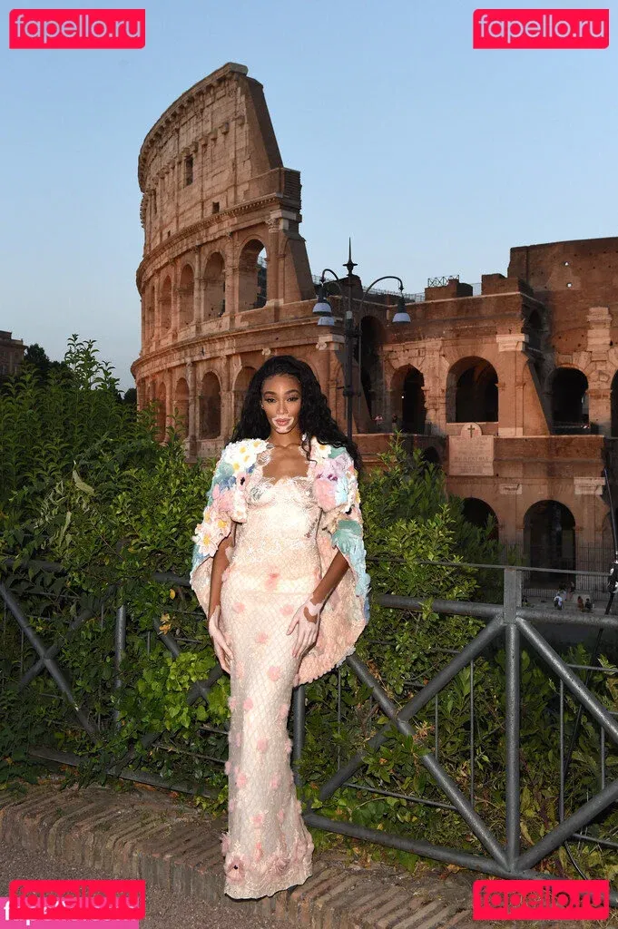 Winnie Harlow Onlyfans Photo Gallery 