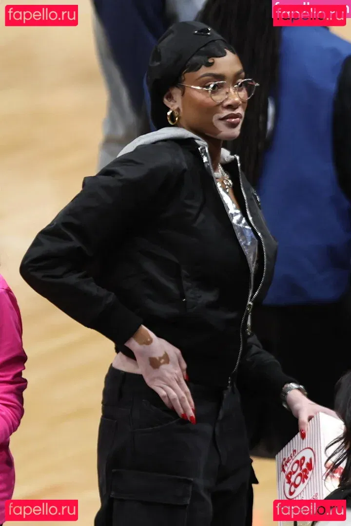 Winnie Harlow Onlyfans Photo Gallery 