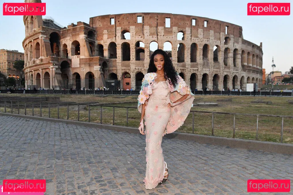 Winnie Harlow Onlyfans Photo Gallery 