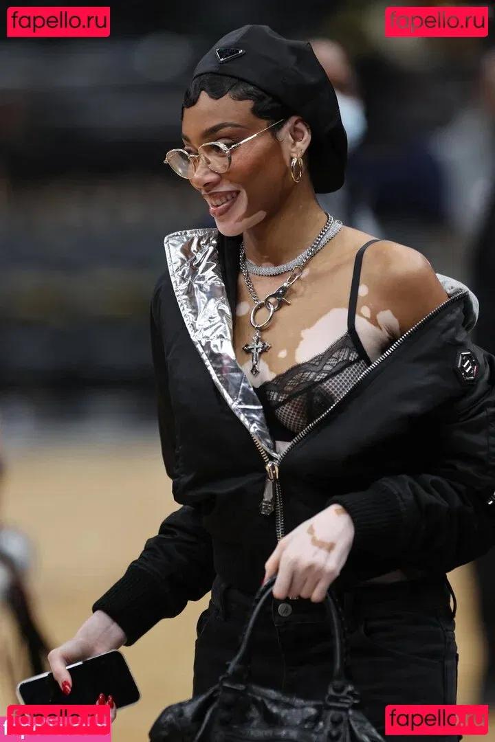 Winnie Harlow Onlyfans Photo Gallery 