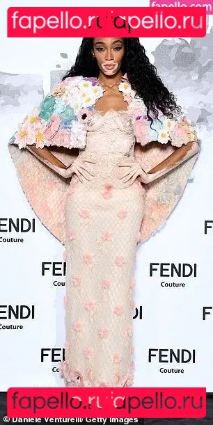 Winnie Harlow Onlyfans Photo Gallery 