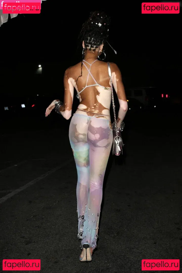 Winnie Harlow Onlyfans Photo Gallery 