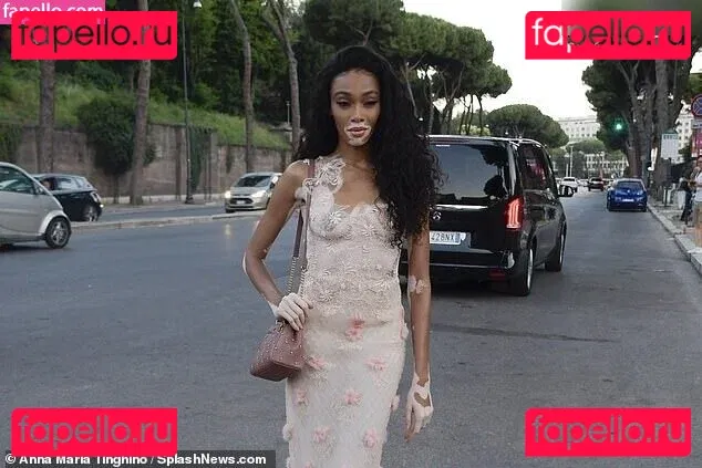 Winnie Harlow Onlyfans Photo Gallery 