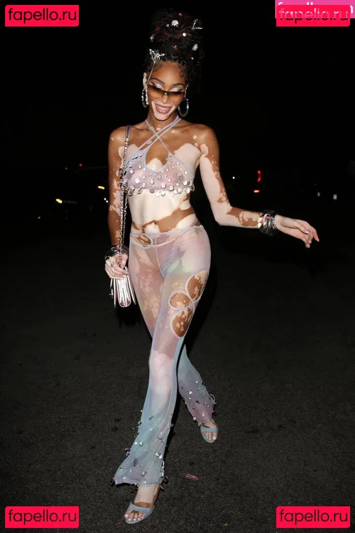 Winnie Harlow Onlyfans Photo Gallery 