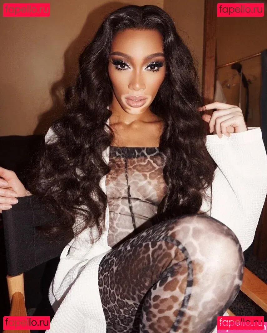 Winnie Harlow Onlyfans Photo Gallery 