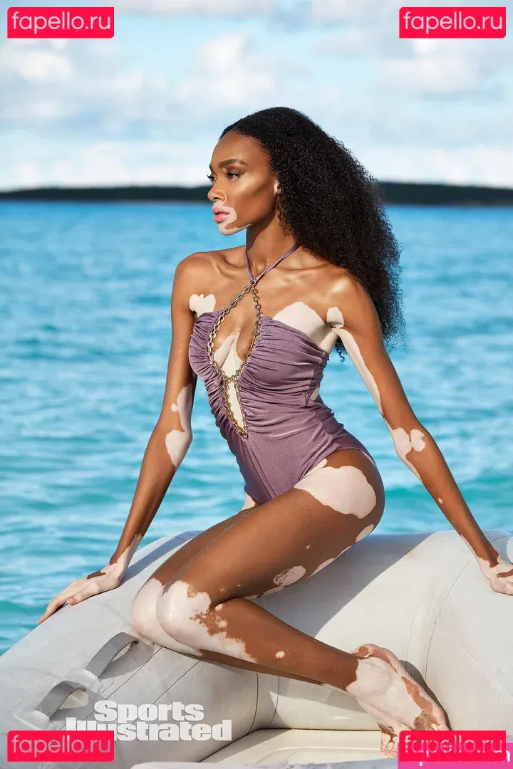 Winnie Harlow Onlyfans Photo Gallery 