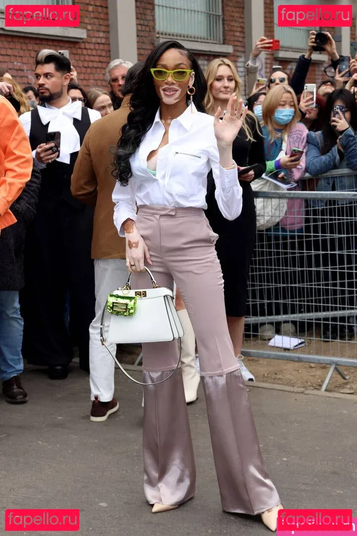 Winnie Harlow Onlyfans Photo Gallery 