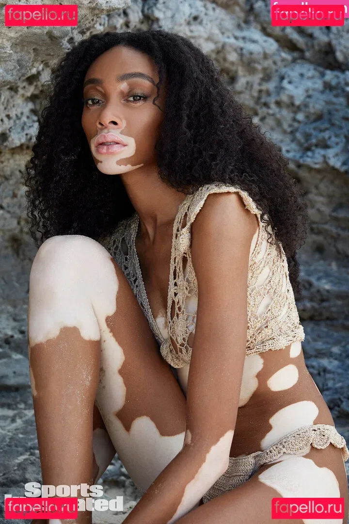 Winnie Harlow Onlyfans Photo Gallery 