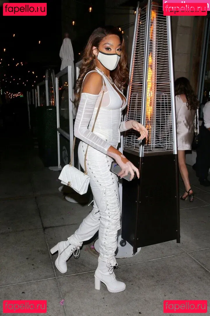 Winnie Harlow Onlyfans Photo Gallery 