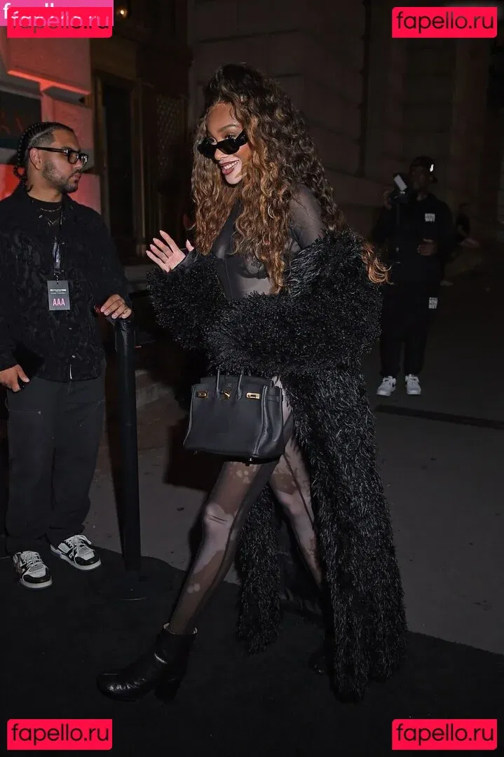 Winnie Harlow Onlyfans Photo Gallery 