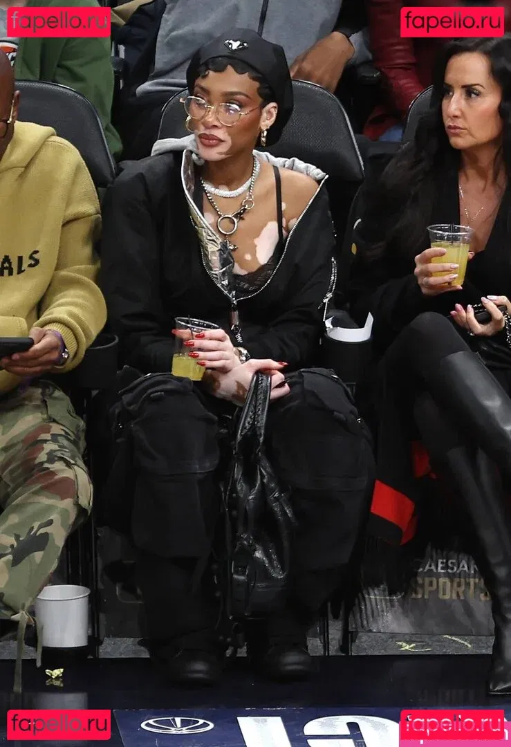 Winnie Harlow Onlyfans Photo Gallery 