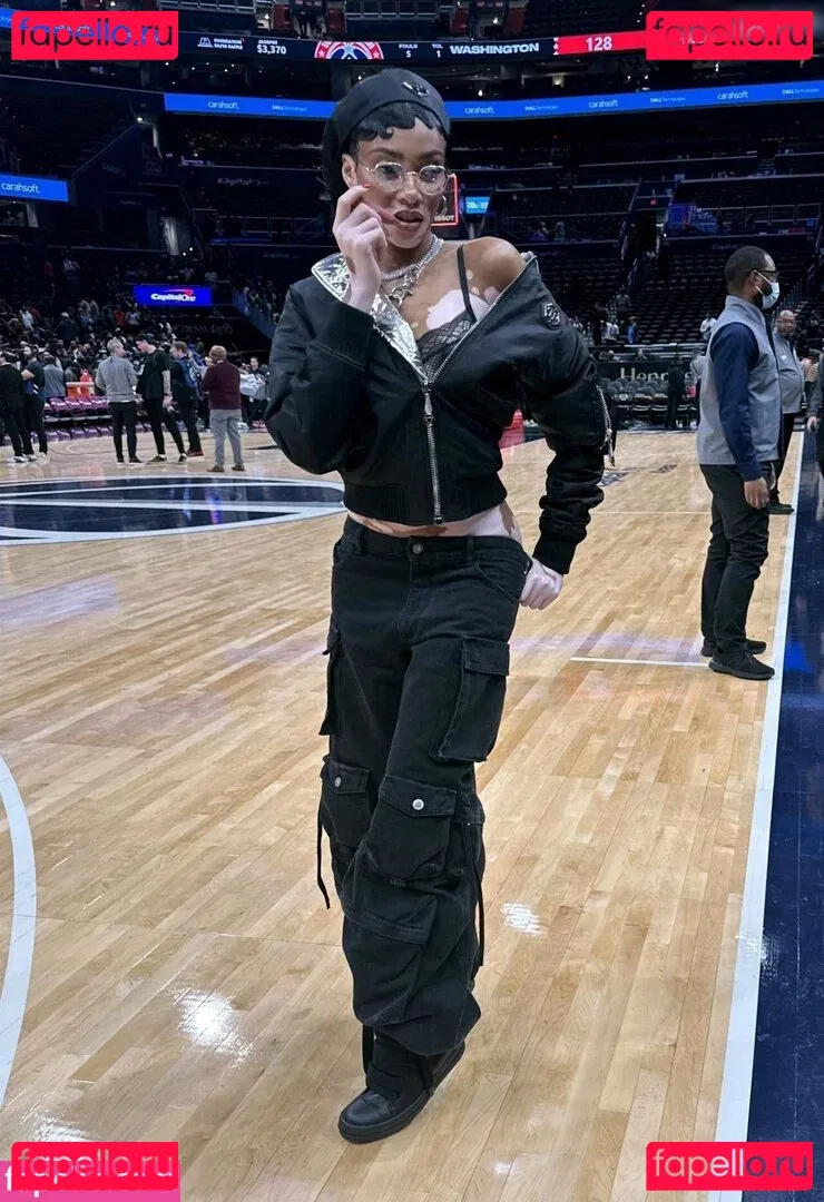 Winnie Harlow Onlyfans Photo Gallery 