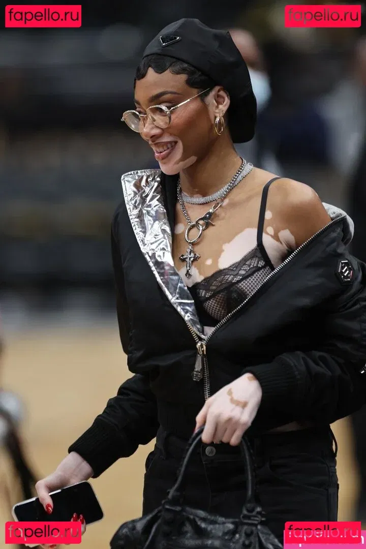 Winnie Harlow Onlyfans Photo Gallery 