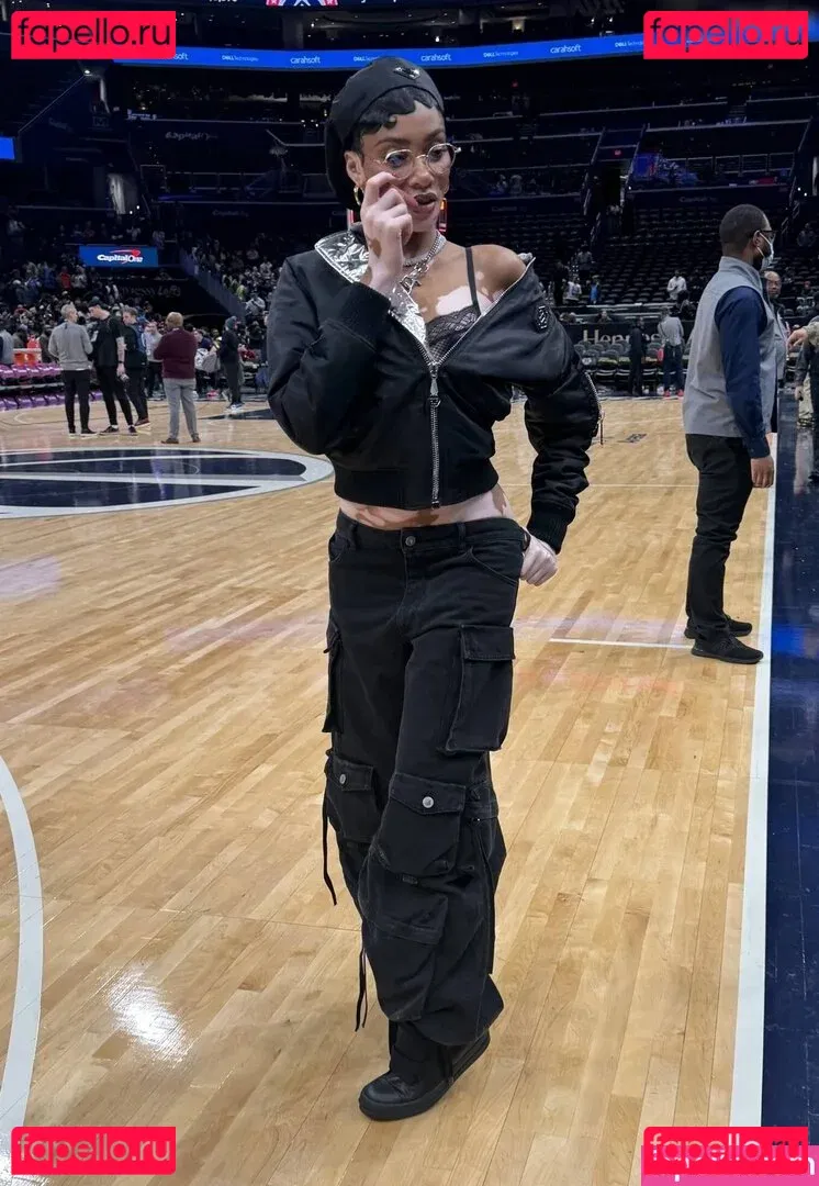 Winnie Harlow Onlyfans Photo Gallery 