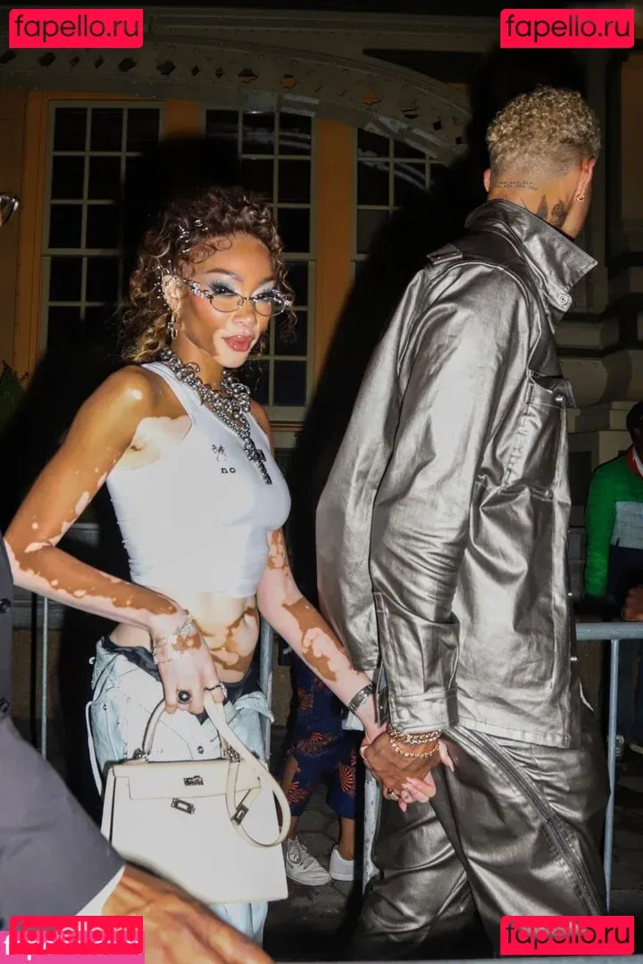 Winnie Harlow Onlyfans Photo Gallery 