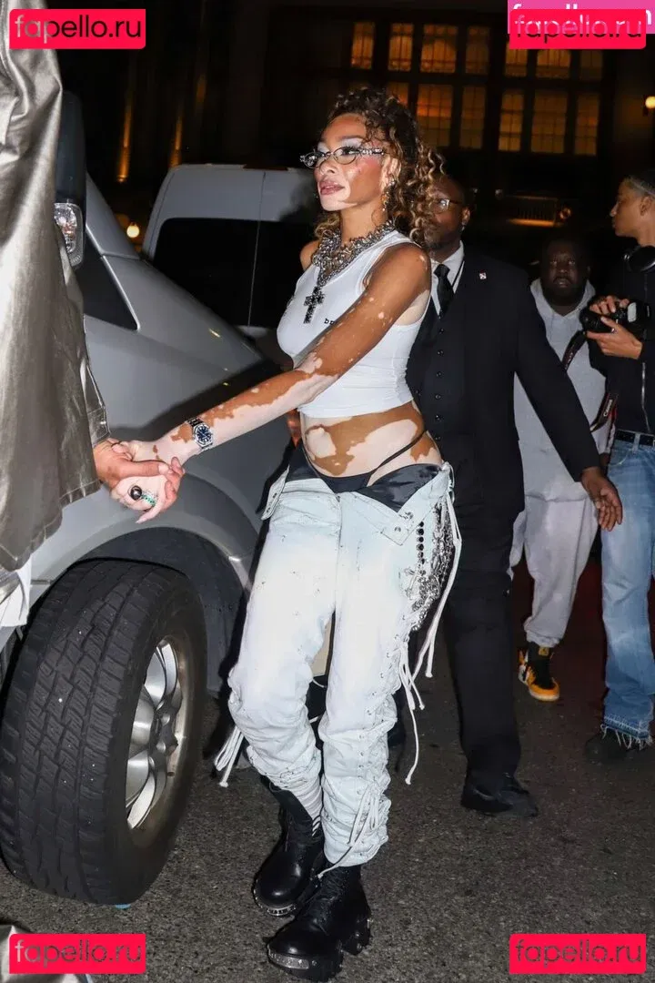 Winnie Harlow Onlyfans Photo Gallery 