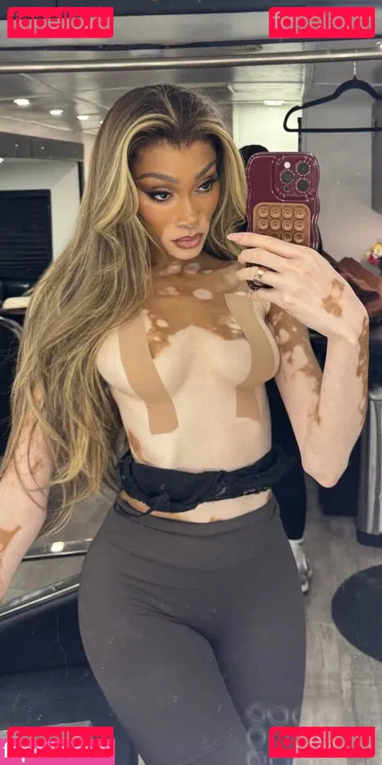 Winnie Harlow Onlyfans Photo Gallery 