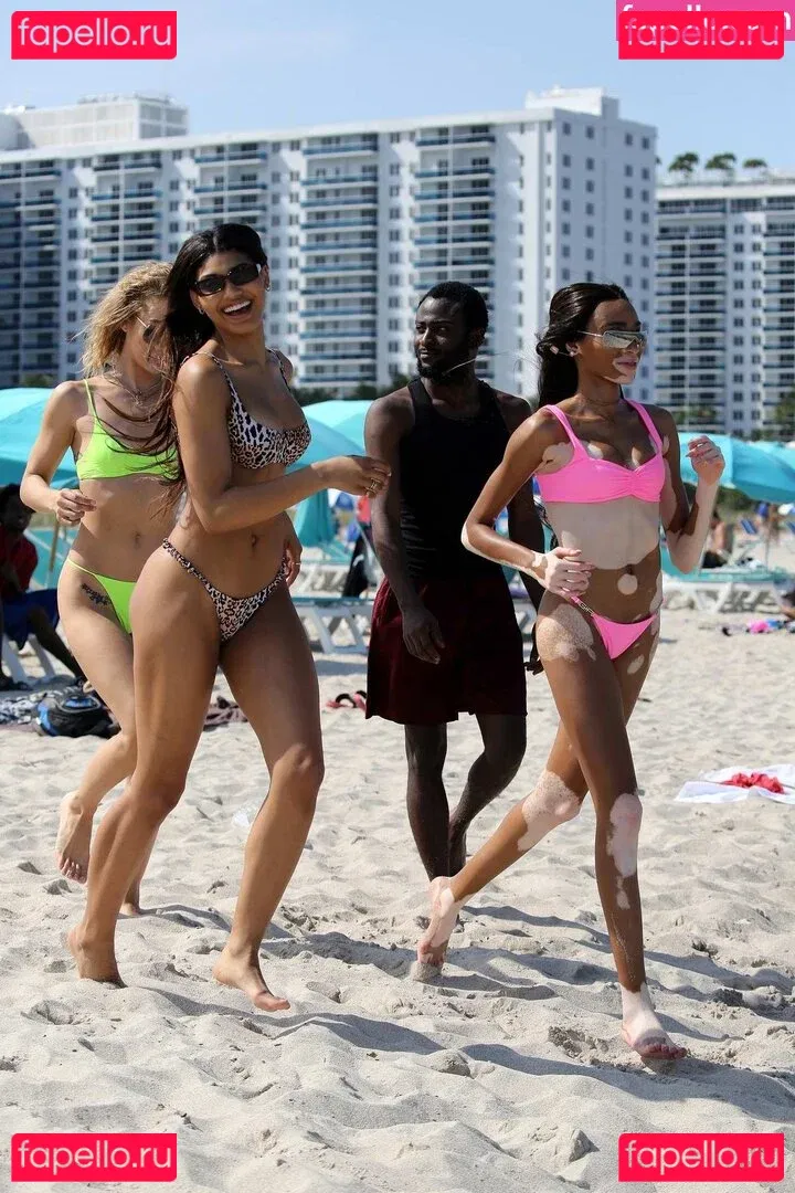 Winnie Harlow Onlyfans Photo Gallery 