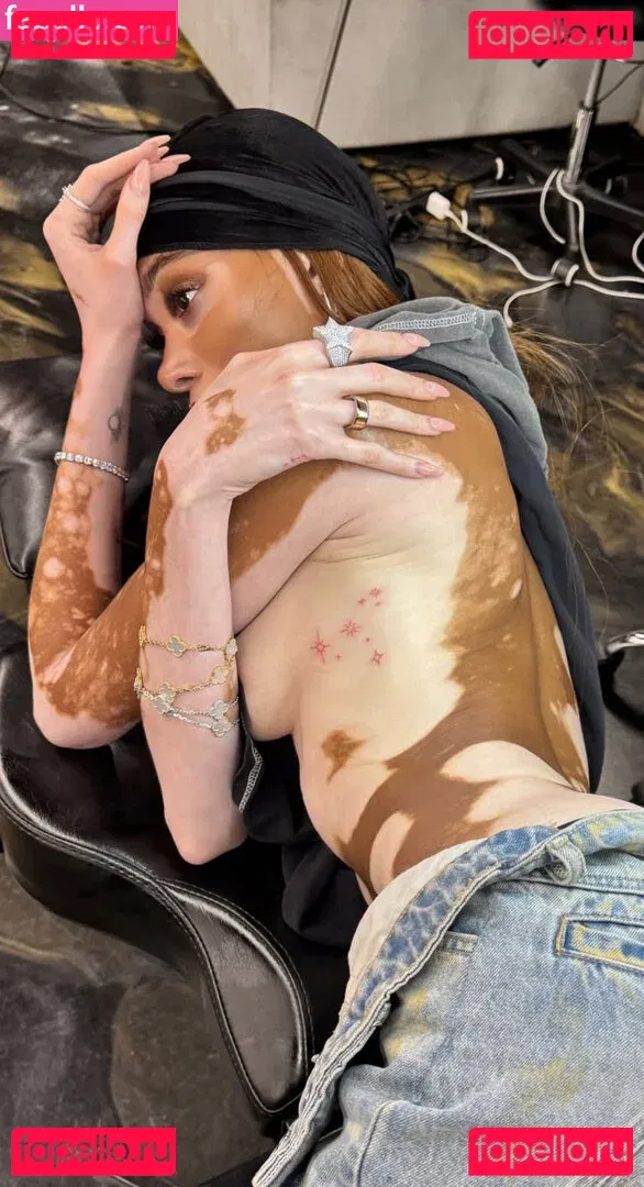 Winnie Harlow Onlyfans Photo Gallery 